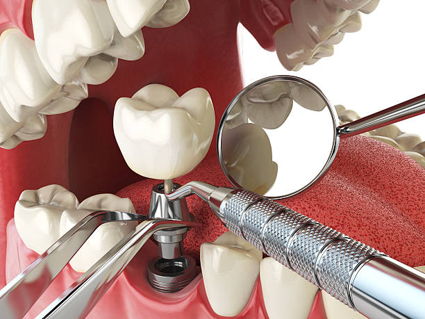 Best Emergency Gum Treatment in Mahtomedi, MN